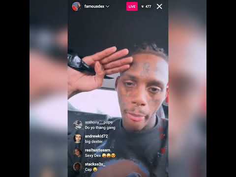 Famous Dex Explains His Teeth And Ankle Monitors