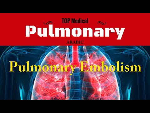 Pulmonary Embolism (Arabic)