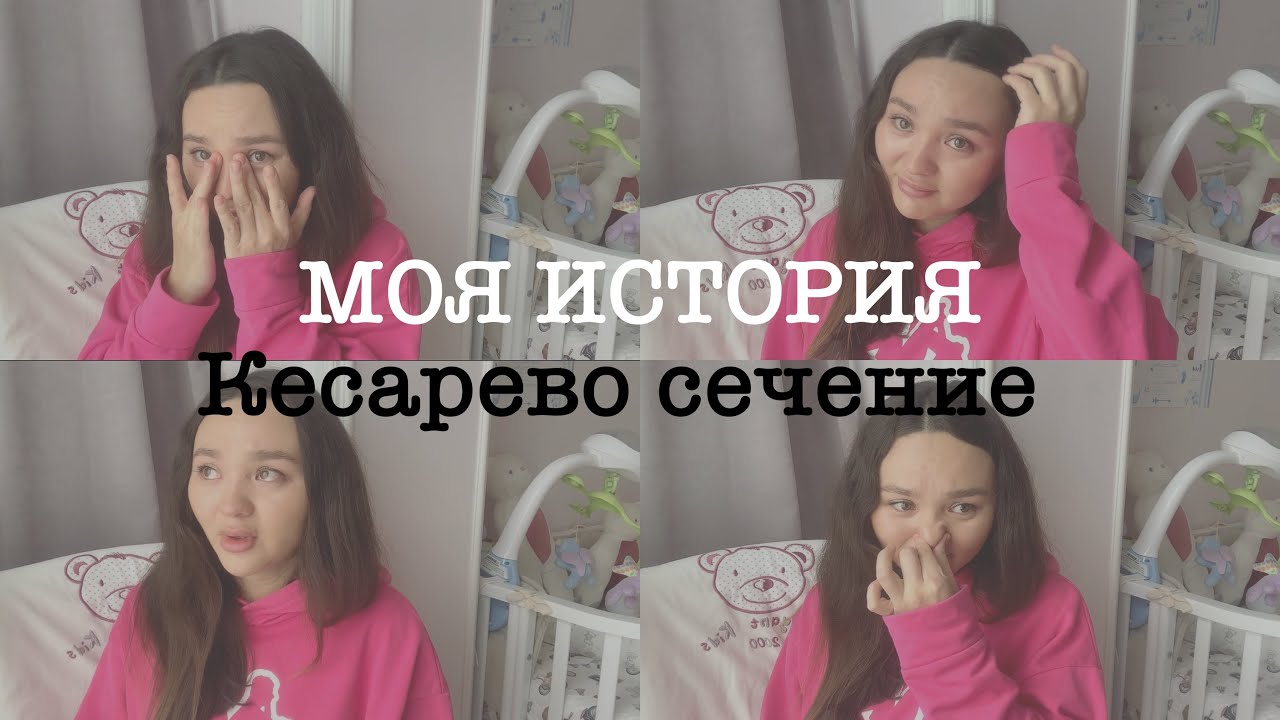 МОИ РОДЫ : Моя история / кесарево сечение
