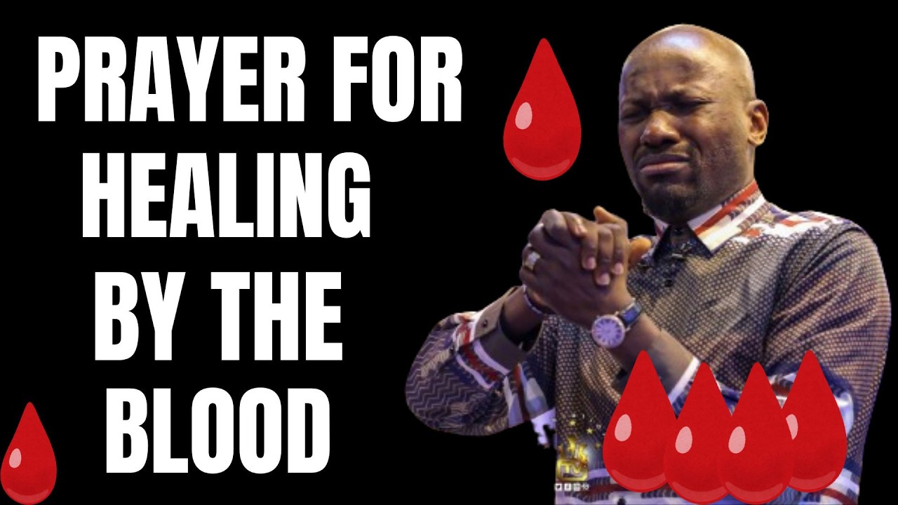 Prayer for Total and Healing and Deliverance with Apostle Johnson Suleman