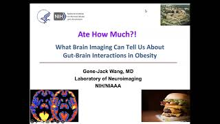 BrainMap: What Brain Imaging Can Tell Us About Gut-Brain Interactions in Obesity