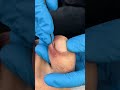Satisfying nail cleaning process#nailcare #pedicure #satisfying #nailtech #oddlysatisfying #fyp
