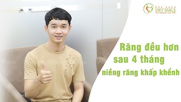 Kết quả sau 4 tháng niềng răng khấp khểnh - KH. Nguyễn Hoàng Phúc S3378