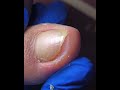 Gentle Toe Grooming | Fresh and Healthy Nail Look #toenailcare #pedicure #pedicureroutine #fypシ