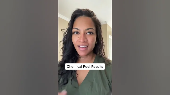 Chemical Peel | Facial Plastic Surgeon Reveals