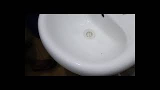 Cleaning Of Toilet Sink Dirts