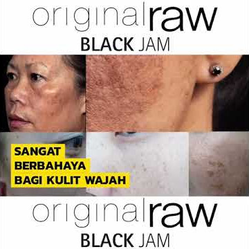 JERAWAT MAMPUS KENA CREAM BLACK JAM