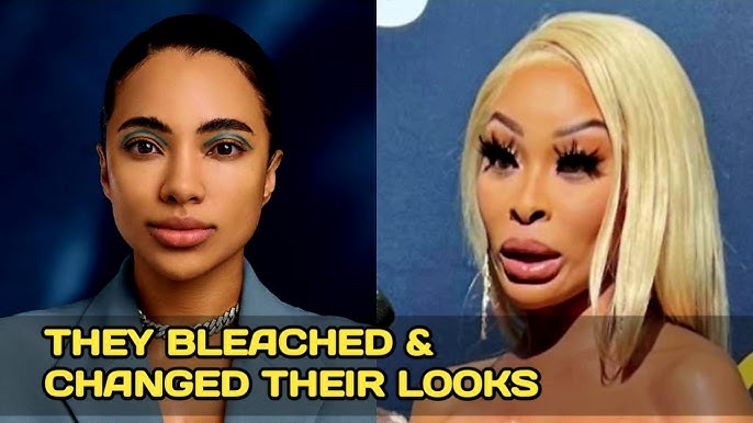 10 Mzansi Actors Who Recently Had Cosmetic Surgery: Before & After Photos