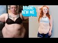 I Lost 246lbs - Today I Reveal My Excess Skin | BRAND NEW ME