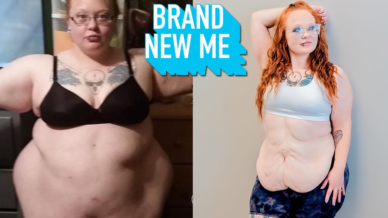 I Lost 246lbs - Today I Reveal My Excess Skin | BRAND NEW ME