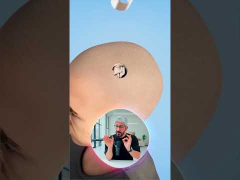 الشريحة المعجزة