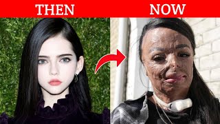 You Wonts Recognize These 🌟After Their Plastic Surgery in 2026😱😱