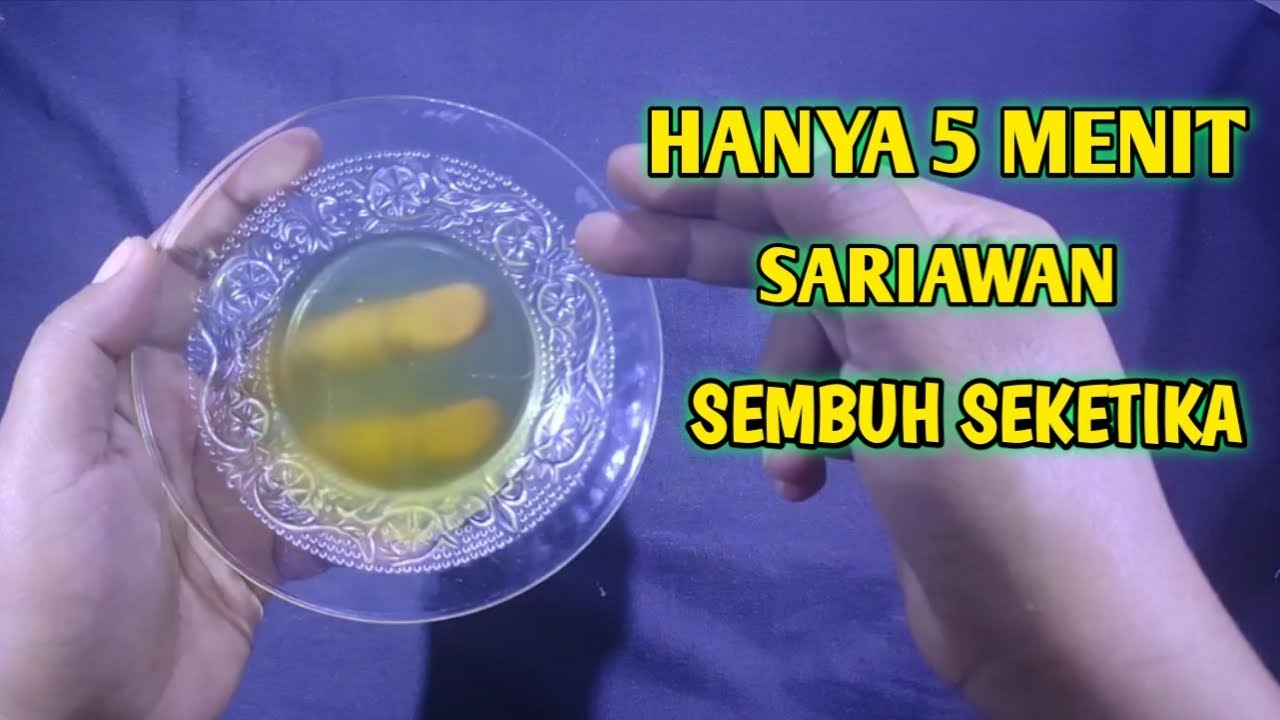 TERBUKTI AMPUH!! Cara Mengobati Sariawan Dengan Cepat Secara Alami