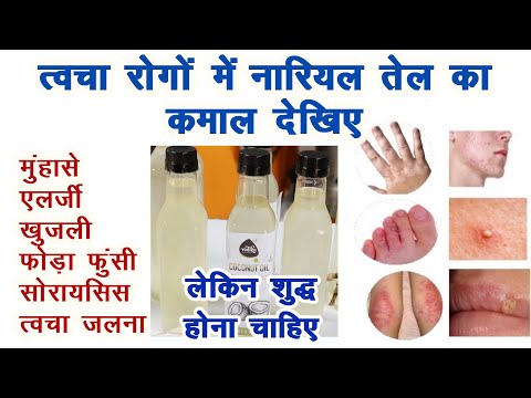 वीडियो: क्या टैकल जेल का दाग अंततः सूख जाएगा?