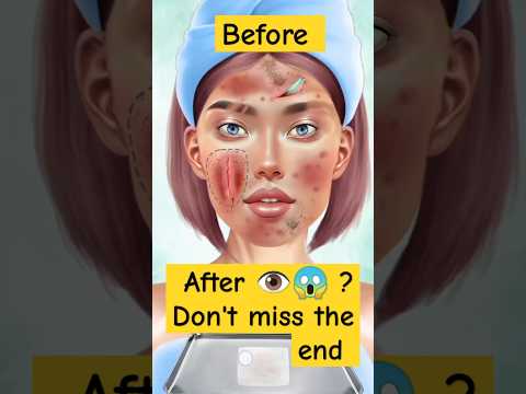 ASMR Satisfying skin care Treatment ASMR |and transform #asmr#skincare #sorts #beauty  #fashiondoll