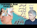 Leukorrhea facial hair acne and its homeopathic treatment  hindi and urdu   drali muhammad