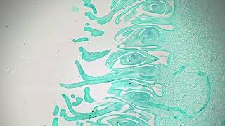 Fruit Of Ficus Carica In Transversal Section Magnified Under Microscope 100X