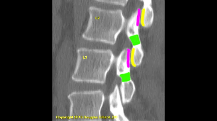 Spinal Anatomy: The Lumbar Spine--An Advanced Lect...