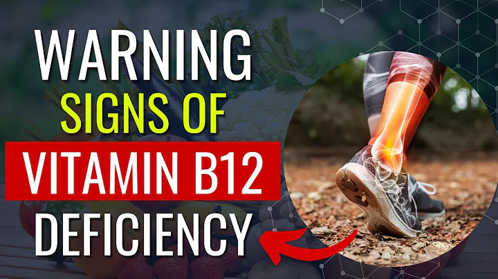 Warning Signs of Vitamin B12 Deficiency You Should Never Ignore!