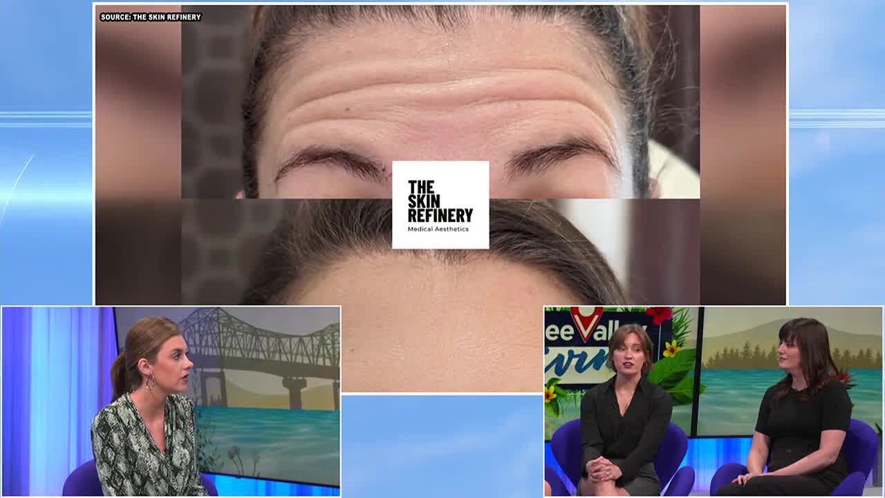 The answers to commonly asked questions on Botox