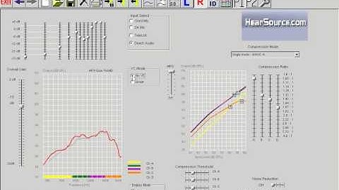 Volume Control Mode - HearSource Hearing Aid Software
