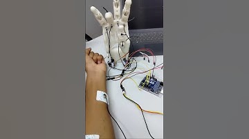 EMG Prosthetic in Action!”“Arduino + EMG = Prosthetic Hand 🤖”
