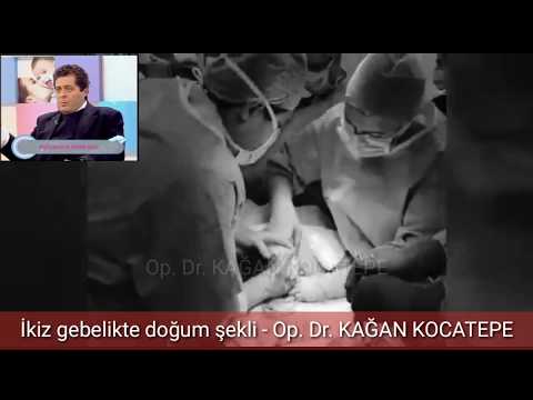 Video: İkizler Neden Doğar?