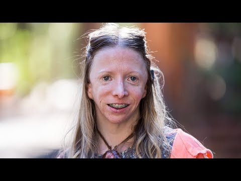 My Rare Facial Deformity Nearly Ruined My Life | Born Different Series