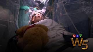 ‘I got my life back’: Anorexia patient undergoes Deep Brain Stimulation | From the Archive