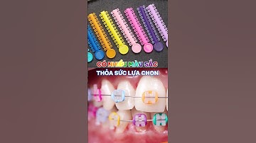 Niềng răng mà nhiều màu sắc vậy sao?