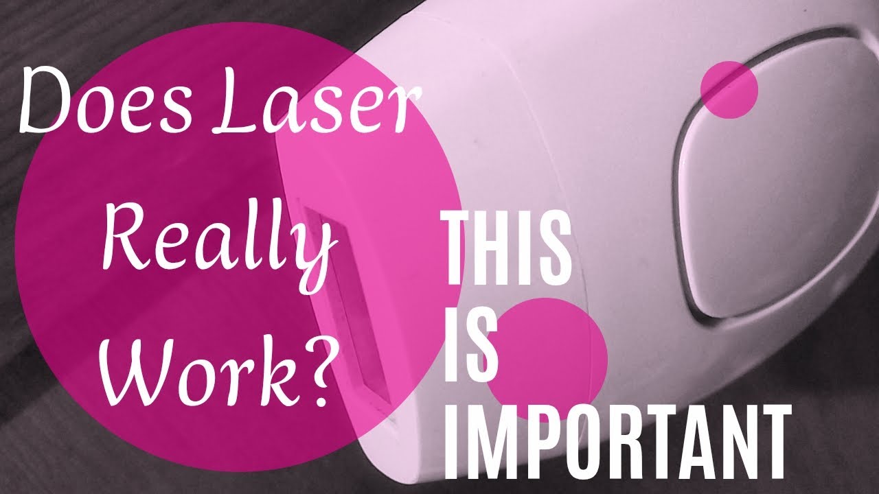 The Truth About Laser Hair Removal | My Real Results 😳