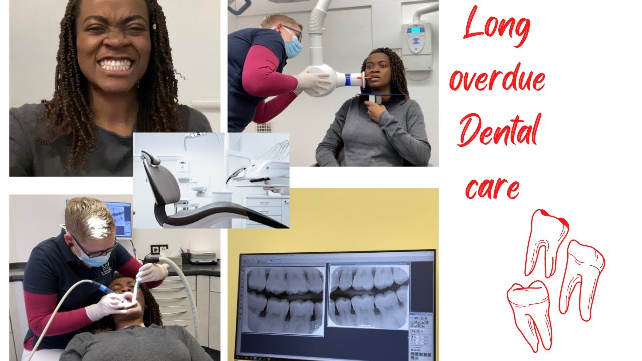 A day in the life of a Nigerian student Mum in Germany | Dental care Vlog - long overdue PART 1