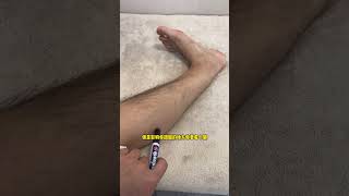 After ankle surgery the Angle is limited the top of the foot gets stuck and the Achill