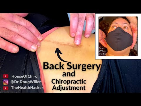 SPINAL SURGERY ~ HOW I GIVE a PATIENT a CHIROPRACTIC adjustment AFTER SURGERY!