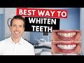 Turn Your Yellow Teeth White! | How to fix YELLOW teeth