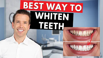 Are yellow teeth temporary?