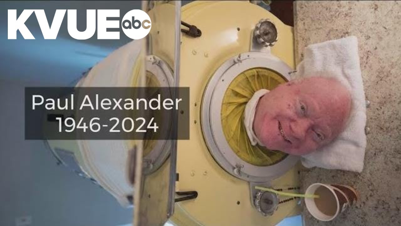 ‘The Man in the Iron Lung’ dies at 78 — Transcript