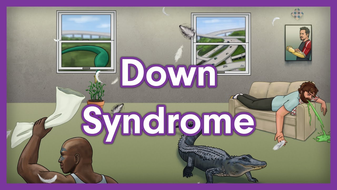 Down Syndrome Trisomy 21 USMLE Step 1 Mnemonic YouTube