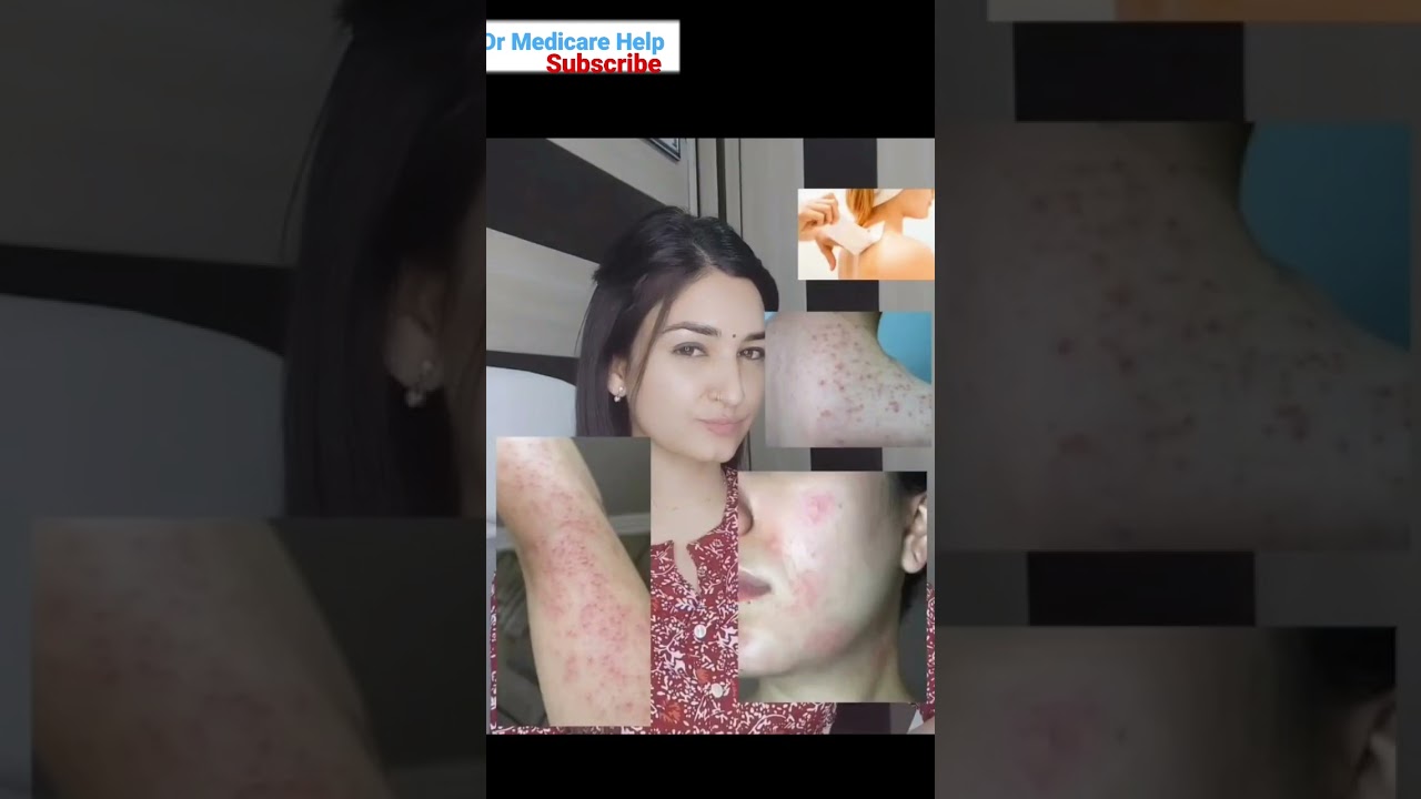 Skin care tips for Bride to be||Avoid waxing||