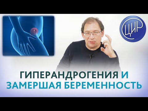 Гиперандрогения. Может ли рост дигидротестостерона и андростендиона вызвать замершую беременность