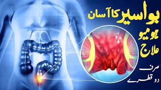 bawaseer ka ilaj | homeopathic medicine for piles | piles medicine