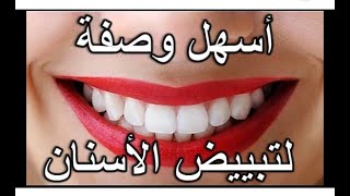 طريقه سحريه لتبيض الاسنان في البيت خلال دقيقه فقط