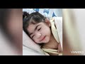 Life Story of my Daughter with Birth Injury(HIE)B-3Y | Brain damage with HIE story