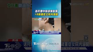 控照顧疏失! 18歲重症女送托養中心滿身傷 盥洗時竟「溺斃」｜TVBS新聞 @TVBSNEWS01