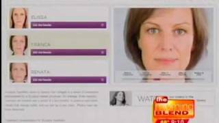 Facial Fillers - What are the differences?