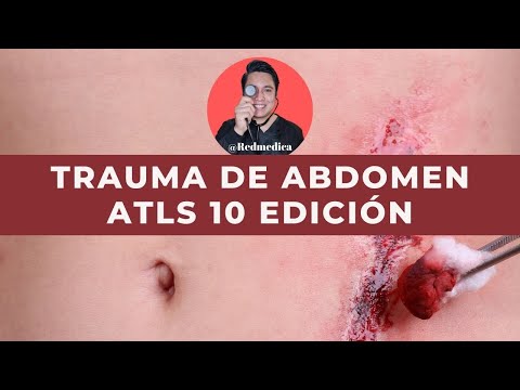 Video: Atracción Al Trauma