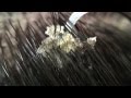 【フケpart7】毛穴たくさんグロテスクなフケgross !! I peeled off the pores of many dandruff.