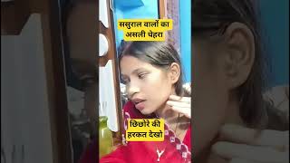 ससरल वल क असल चहर?