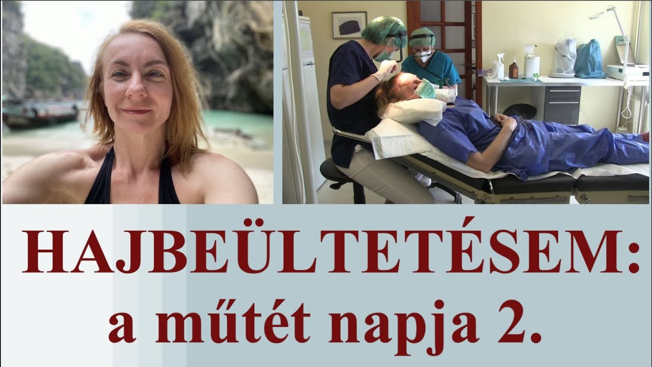 mennyibe kerül a hyperopia műtét)