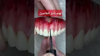 طقم أسنان متحرك الأسنان تشبه شكل ولون الأسنان الطبيعية